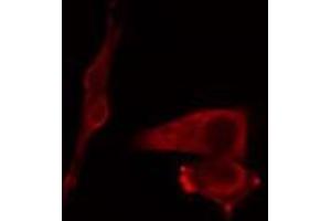 ABIN6269002 staining COLO205 cells by IF/ICC. (COL2A1 抗体  (N-Term))