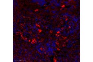 Immunofluorescence (Paraffin-embedded Sections) (IF (p)) image for anti-Membrane-Spanning 4-Domains, Subfamily A, Member 2 (Fc Fragment of IgE, High Affinity I, Receptor For, beta Polypeptide) (MS4A2) antibody (ABIN7074594)