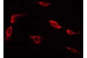 ABIN6272391 staining 293 by IF/ICC. (MRPL41 抗体)