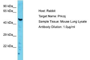 Host: Rabbit Target Name: Prkcq Sample Type: Mouse Lung lysates Antibody Dilution: 1. (PKC theta 抗体  (C-Term))