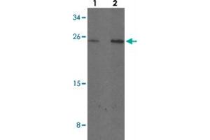 Western blot analysis of MYCT1 in rat lung tissue with MYCT1 polyclonal antibody  at (1) 1 and (2) 2 ug/mL. (Myc Target 1 抗体  (C-Term))