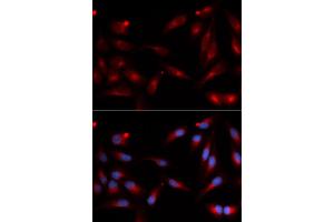 Immunofluorescence (IF) image for anti-ADAM Metallopeptidase Domain 9 (ADAM9) antibody (ABIN1876576) (ADAM9 抗体)