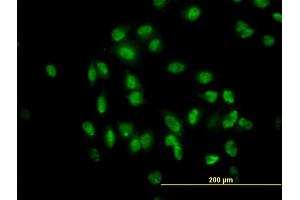 Immunofluorescence of monoclonal antibody to TULP2 on HeLa cell. (TULP2 抗体  (AA 141-250))