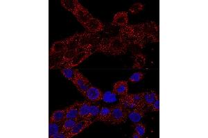 Confocal immunofluorescence analysis of A-431 cells using RPL21 antibody (ABIN7269996) at dilution of 1:100. (RPL21 抗体  (AA 1-160))