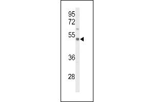 Western Blotting (WB) image for anti-Solute Carrier Family 39 (Zinc Transporter), Member 8 (SLC39A8) (AA 218-246) antibody (ABIN653308)