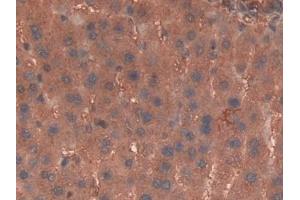 Immunohistochemistry (IHC) image for anti-Haptoglobin (HP) (AA 104-346) antibody (ABIN7443863)