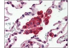 Immunohistochemistry (IHC) image for anti-Clusterin (CLU) (AA 1-333), (N-Term) antibody (ABIN317504) (Clusterin 抗体  (N-Term))