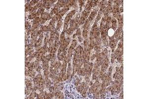 Immunohistochemical staining of human liver with FAM186B polyclonal antibody  shows strong cytoplasmic positivity in hepatocytes at 1:50-1:200 dilution. (FAM186B 抗体)