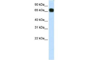 WB Suggested Anti-ZFP64 Antibody Titration:  1. (ZFP64 抗体  (C-Term))