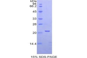 SDS-PAGE analysis of Human PPARD Protein. (PPARD 蛋白)