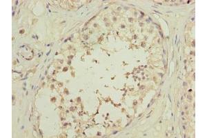 Immunohistochemistry of paraffin-embedded human testis tissue using ABIN7162226 at dilution of 1:100 (PLAC1L 抗体  (AA 74-158))