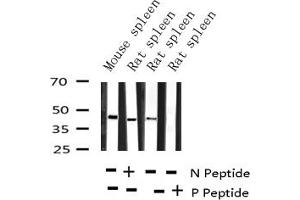 Western blot analysis of Phospho-CCR5 (Ser336) expression in various lysates (CCR5 抗体  (pSer336))