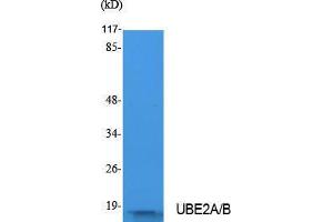 Western Blotting (WB) image for anti-UBE2A/B (C-Term) antibody (ABIN3180974) (UBE2A/B (C-Term) 抗体)