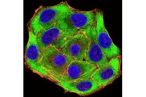 Immunocytochemistry (ICC) image for anti-Ubiquitin Fusion Degradation Protein 1 Homolog (UFD1L) (AA 208-307) antibody (ABIN5542400)
