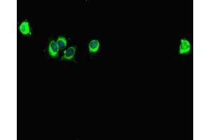 Immunofluorescent analysis of Hela cells using ABIN7146024 at dilution of 1:100 and Alexa Fluor 488-congugated AffiniPure Goat Anti-Rabbit IgG(H+L) (SPAG9 抗体  (N-Term))