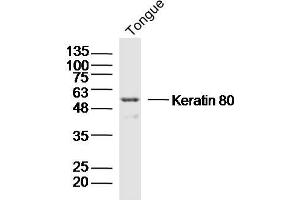 Mouse tongue lysates probed with Keratin 80 Polyclonal Antibody, Unconjugated  at 1:300 dilution and 4˚C overnight incubation. (KRT80 抗体  (AA 101-200))