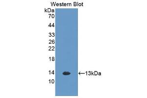 Western blot analysis of the recombinant protein. (CXCL1 抗体  (AA 25-96))