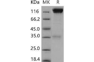 Western Blotting (WB) image for Protein tyrosine Phosphatase, Receptor Type, C (PTPRC) (Active) protein (Fc Tag) (ABIN7320178) (CD45 Protein (Fc Tag))