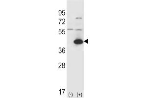 Western Blotting (WB) image for anti-Glutamic-Oxaloacetic Transaminase 1, Soluble (Aspartate Aminotransferase 1) (GOT1) antibody (ABIN3001737)