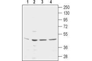 Western blot analysis using Mouse Anti-KCNN4 (KCa3. (KCNN4 抗体  (3rd Extracellular Loop, Extracellular Loop))