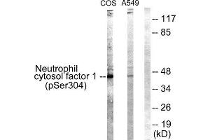 Western Blotting (WB) image for anti-Neutrophil Cytosol Factor 1 (NCF1) (pSer304) antibody (ABIN1847418) (NCF1 抗体  (pSer304))