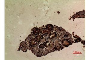 Immunohistochemistry (IHC) image for anti-Lymphocyte Cytosolic Protein 2 (SH2 Domain Containing Leukocyte Protein of 76kDa) (LCP2) (Internal Region) antibody (ABIN6282745)