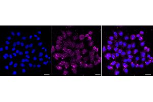 Immunocytochemical staining of HepG2 cells with CD46 antibody (ABIN7797974), 1:1,000). (Recombinant CD46 抗体)