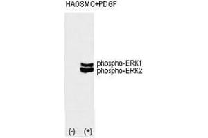 Western blot analysis of phospho-ERK1/2 antibody and HAOSMC cell lysate noninduced (lane 1) or induced with the PDGF (lane 2).