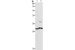 Gel: 10 % SDS-PAGE, Lysate: 40 μg, Lane 1-2: Mouse muscle tissue, Mouse skin tissue, Primary antibody: ABIN7189850(APOBEC2 Antibody) at dilution 1/450, Secondary antibody: Goat anti rabbit IgG at 1/8000 dilution, Exposure time: 10 seconds (APOBEC2 抗体)
