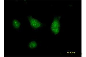 Immunofluorescence of purified MaxPab antibody to CISH on HeLa cell. (CISH 抗体  (AA 1-258))