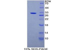 SDS-PAGE analysis of Rat Alanine Aminopeptidase Protein. (ALT 蛋白)