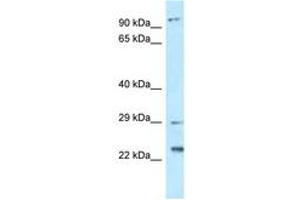 C17orf70 抗体  (AA 92-141)