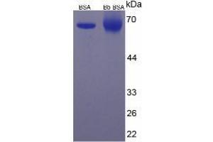 Bilirubin protein (BSA)