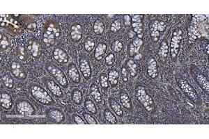 IHC analysis of MIEF1 using anti-MIEF1 antibody (ABIN7600396).