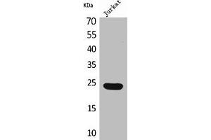 Western Blot analysis of Jurkat cells using IFN-ε Polyclonal Antibody (IFNE 抗体  (C-Term))