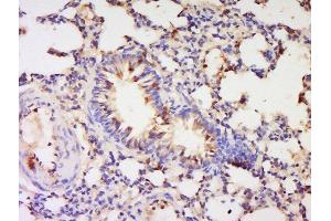 Formalin-fixed and paraffin embedded rat lung labeled with Anti-PBEF1 Polyclonal Antibody, Unconjugated  at 1:200 followed by conjugation to the secondary antibody and DAB staining. (NAMPT 抗体  (AA 301-400))