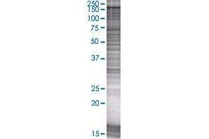 NLRP1 transfected lysate. (NALP1 293T Cell Transient Overexpression Lysate(Denatured))