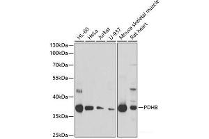 Western blot analysis of extracts of various cell lines using PDHB Polyclonal Antibody at dilution of 1:1000. (PDHB 抗体)