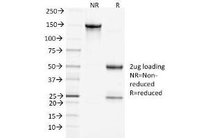 SDS-PAGE Analysis Purified Clathrin, HC Monoclonal Antibody (CHC/1432). (Clathrin Heavy Chain (CLTC) 抗体)