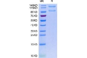 Human ITGAX&ITGB2 on Tris-Bis PAGE under reduced condition.