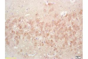 Formalin-fixed and paraffin embedded rat brain labeled with Rabbit Anti PAK7/PAK5/MBT Polyclonal Antibody, Unconjugated (ABIN671496) at 1:200 followed by conjugation to the secondary antibody and DAB staining (PAK7 抗体  (AA 621-719))