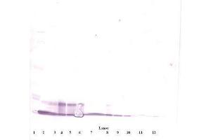 Image no. 4 for anti-Chemokine (C-X-C Motif) Ligand 10 (CXCL10) antibody (ABIN465012) (CXCL10 抗体)