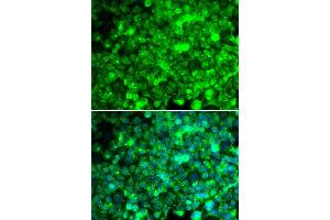Immunofluorescence analysis of U20S cell using ADIPOR1 antibody. (Adiponectin Receptor 1 抗体)