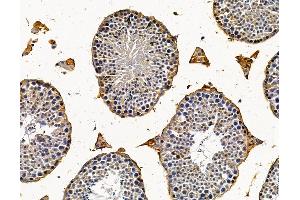 ABIN7096169 and ABIN7100231 at 1/100 staining mouse testis tissue by IHC-P.