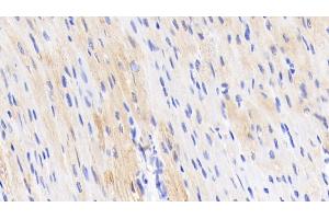 Detection of TNNT2 in Porcine Cardiac Muscle Tissue using Polyclonal Antibody to Troponin T Type 2, Cardiac (TNNT2)