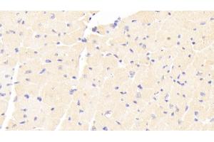 Detection of ADCY7 in Mouse Cardiac Muscle Tissue using Polyclonal Antibody to Adenylate Cyclase 7 (ADCY7) (ADCY7 抗体  (AA 309-491))