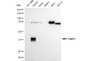 Western blotting analysis using C4BPB antibody (ABIN7798141). (Recombinant C4BPB 抗体)