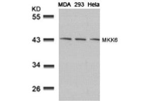 Image no. 3 for anti-Mitogen-Activated Protein Kinase Kinase 6 (MAP2K6) (AA 205-209) antibody (ABIN197355) (MAP2K6 抗体  (AA 205-209))