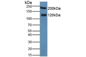 Detection of MGAM in Human Serum using Polyclonal Antibody to Maltase-glucoamylase (MGAM) (Maltase-Glucoamylase (MGAM) (AA 213-392) 抗体)