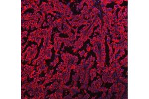 IF analysis of EML4 using anti-EML4 antibody (ABIN6719384).